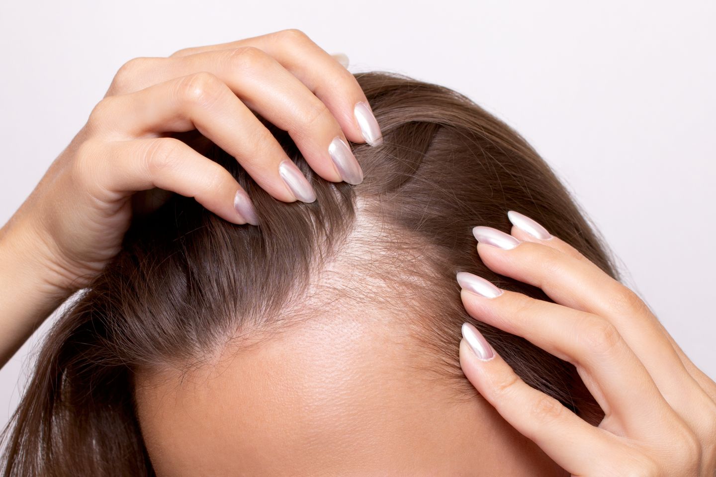 Benefits of PRP Hair Restoration: What You Need to Know