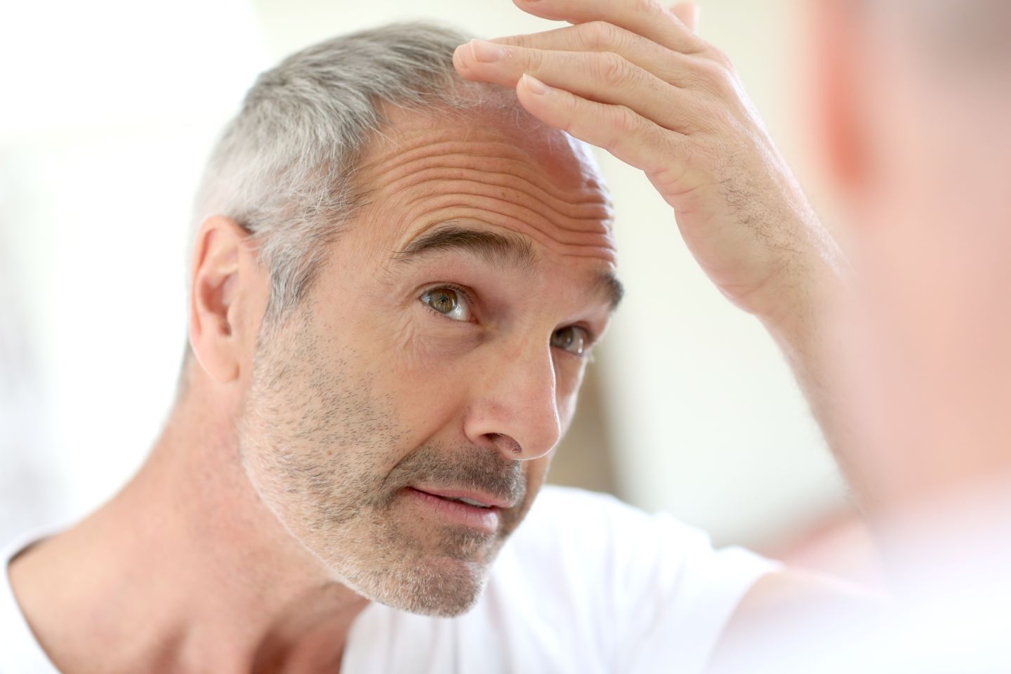 PRP Hair Restoration Results: What to Expect